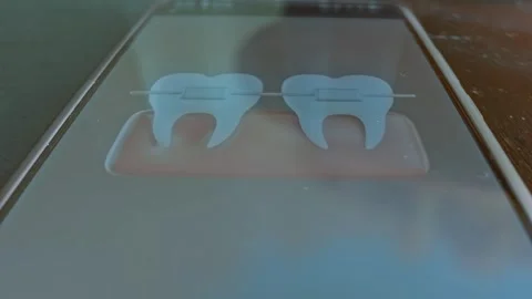 Dental Braces 3D model presentation Stock Footage 304232722