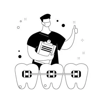 Dental braces abstract concept vector illustration. Stockillustratie