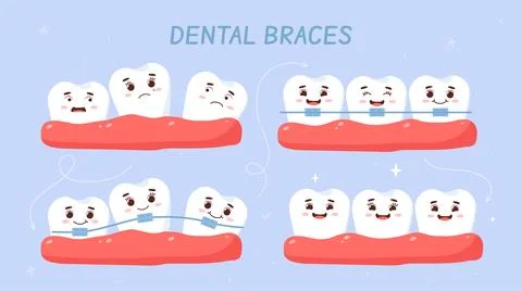 Dental braces vector set Stock Illustration