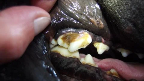 Dental calculus Stock Photos