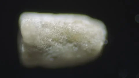 Dental calculus under microscope on black background, reflected light Stock Footage 332987253