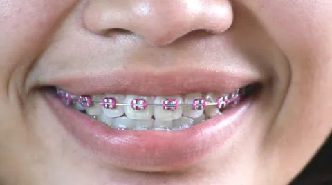 Dental Care Video stock 10727682