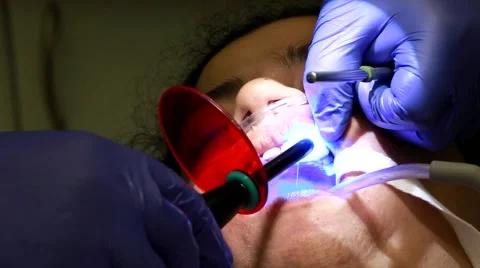 Dental care Stock Footage 63161546