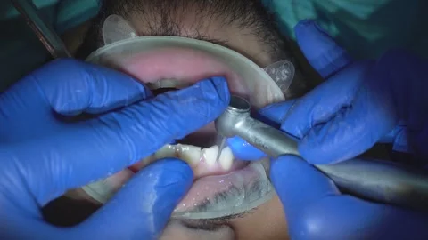 Dental Care Procedure Stock Footage 316913690
