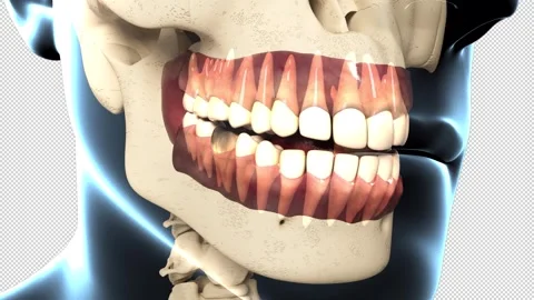 Dental Caries Overview 스톡 동영상 274535546