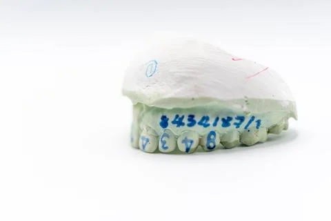 Dental Cast Model for Prosthetic Work Stock Photos