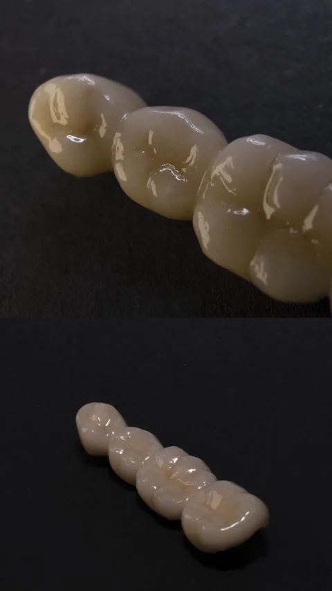 Dental ceramic bridge on isolated black background Stock Footage 315734744