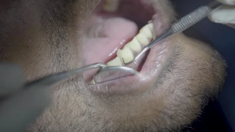Dental Checkup 4 動画素材 287967624