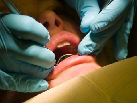 Dental checkup Foto stock