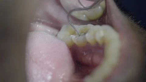 Dental Checkups 3 Video stock 287967579