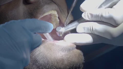 Dental Checkups 6 Video stock 287967623