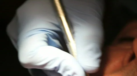 Dental Cleaning 2 Stock Footage 645623