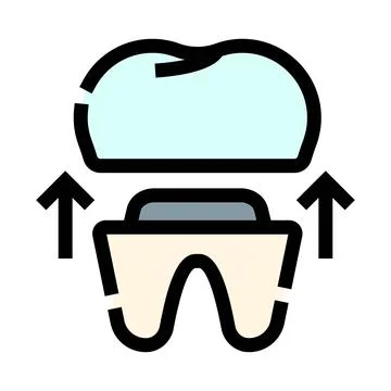 Dental crown installation process over prepared tooth Иллюстрация