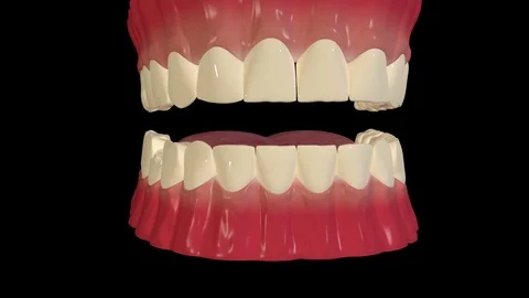 Dental Crown Procedure Stock Footage 127344992