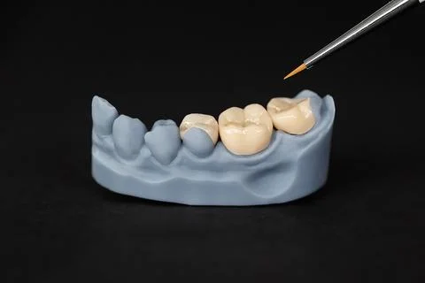 Dental crowns on model during ceramic characterization process Stock Photos