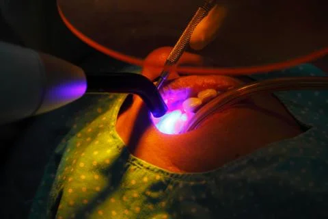 Dental curing light Stock Photos