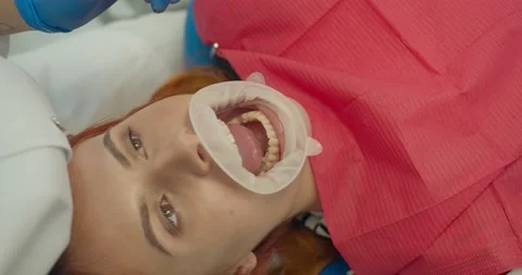 Dental curing light used for teeth treatment, modern equipment, process closeup Stock Footage 137118000