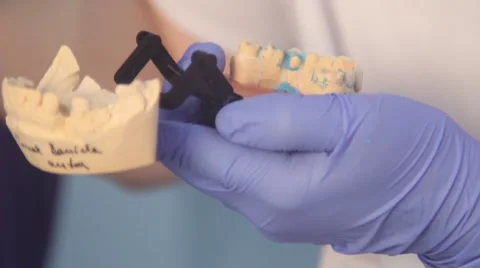 Dental dentist objects implants Stock Footage 61156028