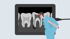 Traditional Dental X Ray Machine Dental Stock Video Pond5