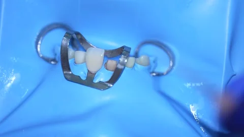 Dental Equipment Close-Up Video stock 316917299