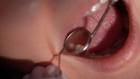 Dental exam concept Stock Footage