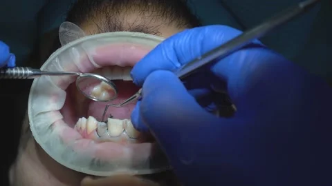 Dental Examination Stock Footage 316913873
