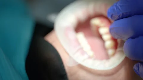 Dental Examination Stock Footage 316915873