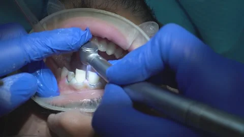 Dental Examination Procedure Stock Footage 316914201