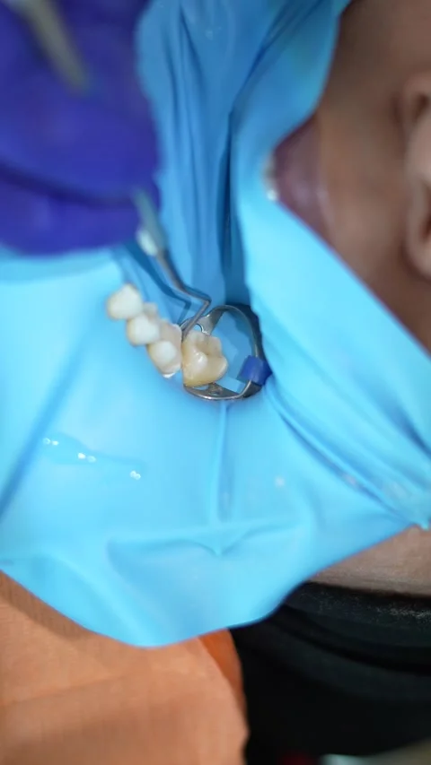 Dental Examination Process Stock Footage 316914503