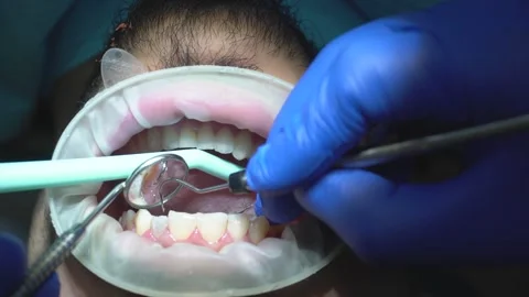 Dental Examination in Progress Stock Footage 316913339