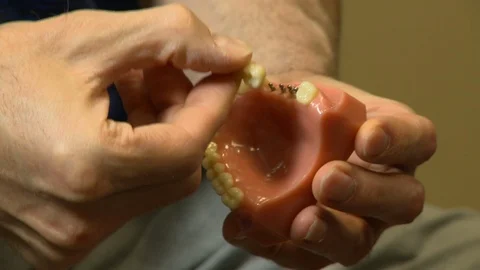 Dental False Teeth Close Up Video stock 113488190
