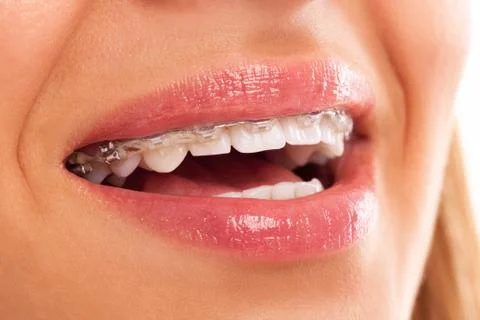 Dental fix prosthesis Stock-Fotos