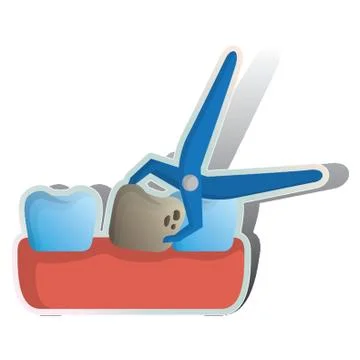 Dental Forceps Pulling Decaying Tooth On Gum Illustrazione stock