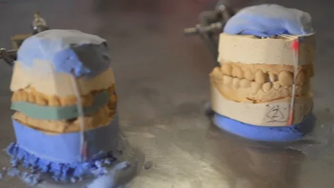 Dental gypsum models on the table, concept of sick tooth Video stock 99283679