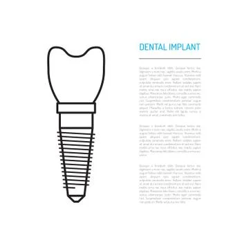 Dental implant vector Stock Illustration