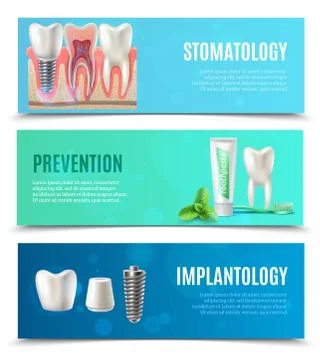 Dental Implants 3 Horizontal Banners Set Stock Illustration