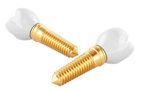 Dental Implants, 3D rendering Stock Illustration