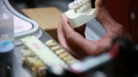 Dental implants (brushing) Stock Footage 11226653