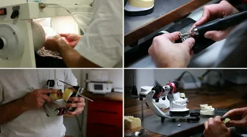 Dental implants composition (brushing and smoothing) Stock Footage 11226611