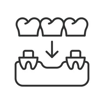 Dental implants procedure, icon in line design. dental, implants, tooth, surgery Stock Illustration