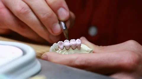 Dental implants sequence (brushing) Stock Footage 11226458