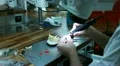 Dental implants (smoothing machine) HD Footage