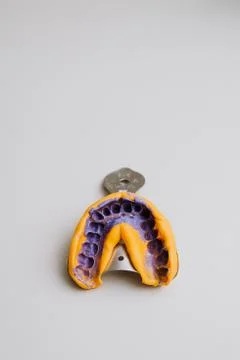 The dental impression is filled with a patch, creating a prosthetic tooth Stock Photos