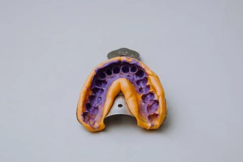 The dental impression is filled with a patch, creating a prosthetic tooth Stock Photos