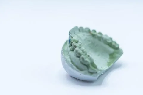 Dental Impression Model of Upper Teeth Stock Photos