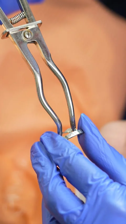 Dental Instrument Close-Up Stock Footage 316914622