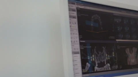 Dental instruments and stuff Stock Footage 43037574