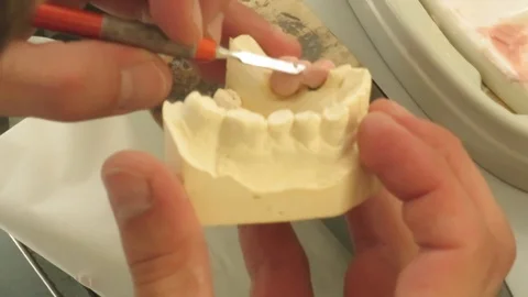 Dental laboratory equipment and processing Stock Footage 88876346