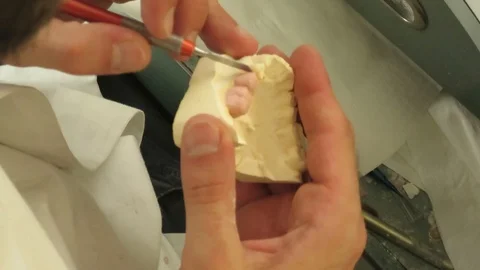 Dental laboratory equipment and processing Stock Footage 88876372