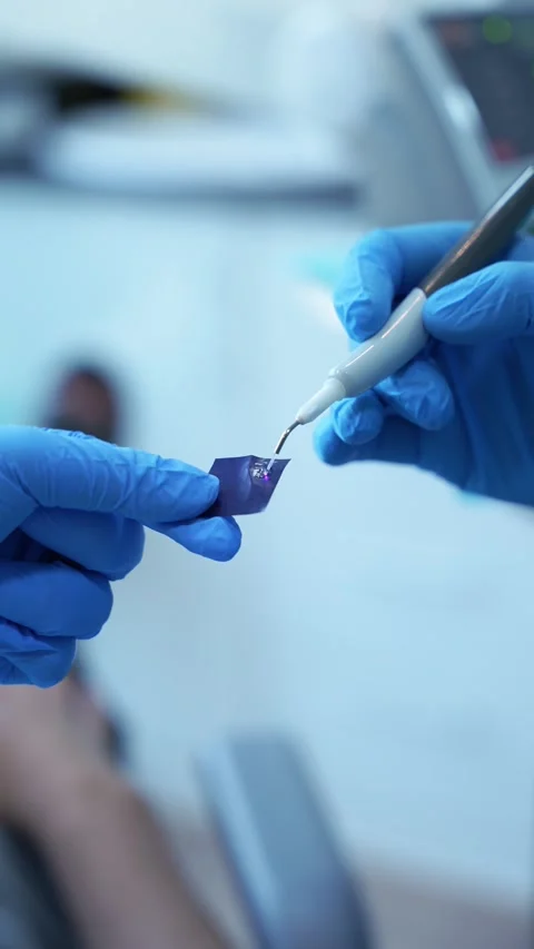 Dental Laser Procedure Stock Footage 331164007